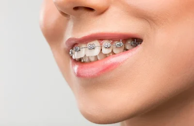 what-is-orthodontics-4